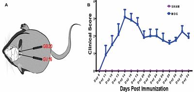 Effects of Retinal Transcription Regulation After GB20 Needling Treatment in Retina With Optic Neuritis